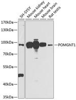 POMGNT1 Antibody in Western Blot (WB)