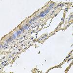 FABP12 Antibody in Immunohistochemistry (Paraffin) (IHC (P))