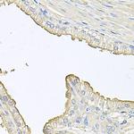 FABP12 Polyclonal Antibody