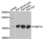 FABP12 Antibody in Western Blot (WB)