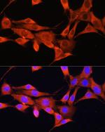 AMT Polyclonal Antibody