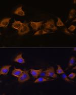 ATP1B2 Polyclonal Antibody
