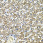 CEP164 Antibody in Immunohistochemistry (Paraffin) (IHC (P))