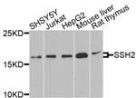 SSH2 Antibody in Western Blot (WB)