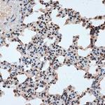 RBM17 Antibody in Immunohistochemistry (Paraffin) (IHC (P))