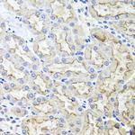 LRP2 Polyclonal Antibody