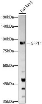 GFPT1 Polyclonal Antibody