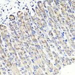 MAPKBP1 Polyclonal Antibody