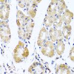 MRPL11 Polyclonal Antibody