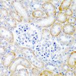 Relaxin 2 Polyclonal Antibody