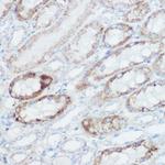 GluD1 Polyclonal Antibody