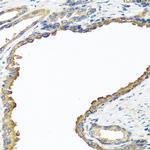 NYX Polyclonal Antibody