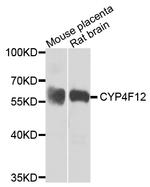 CYP4F12 Polyclonal Antibody