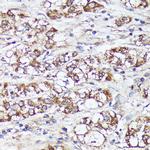 MTHFD2 Antibody in Immunohistochemistry (Paraffin) (IHC (P))