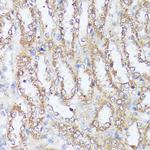 MTHFD2 Antibody in Immunohistochemistry (Paraffin) (IHC (P))