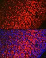 HSD3B1 Polyclonal Antibody