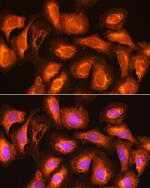 SEC11A Polyclonal Antibody