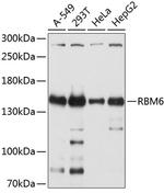 RBM6 Polyclonal Antibody
