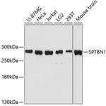 SPTBN1 Polyclonal Antibody
