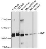 MYT1 Antibody in Western Blot (WB)