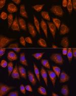 GOLGA4 Antibody in Immunocytochemistry (ICC/IF)