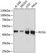 RCN1 Polyclonal Antibody