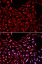 MB67 Polyclonal Antibody