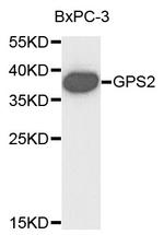 GPS2 Polyclonal Antibody