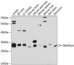 TRMT61A Antibody in Western Blot (WB)