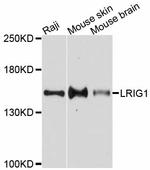 LRIG1 Polyclonal Antibody