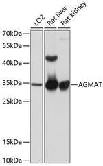 AGMAT Polyclonal Antibody