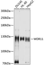 BRWD2 Polyclonal Antibody