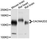 CACNA2D2 Polyclonal Antibody