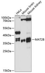MAT2B Polyclonal Antibody