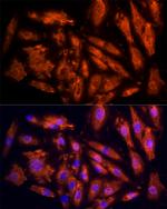 IL17C Antibody in Immunocytochemistry (ICC/IF)