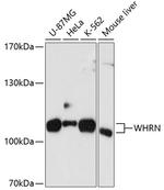 DFNB31 Polyclonal Antibody