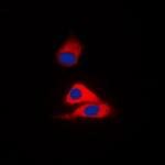 MVK Polyclonal Antibody