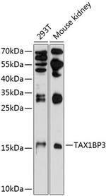TAX1BP3 Polyclonal Antibody