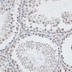 AQR Antibody in Immunohistochemistry (Paraffin) (IHC (P))