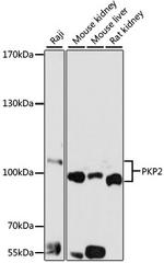 PKP2 Polyclonal Antibody