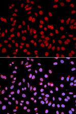 POLR2J Antibody in Immunocytochemistry (ICC/IF)
