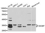 Syntenin 1 Antibody in Western Blot (WB)