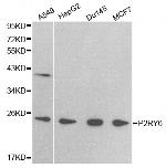 P2Y6 Polyclonal Antibody
