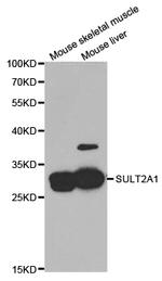 SULT2A1 Polyclonal Antibody