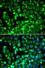 DLD Polyclonal Antibody