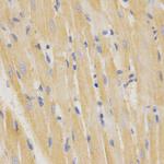 SFTPC Antibody in Immunohistochemistry (Paraffin) (IHC (P))
