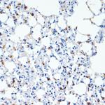 SFTPC Polyclonal Antibody