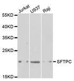 SFTPC Antibody in Western Blot (WB)