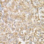 GLB1 Polyclonal Antibody