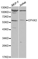 EPHX2 Polyclonal Antibody